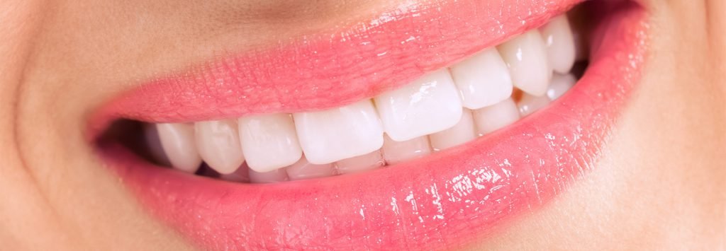 Dental smile after treatment