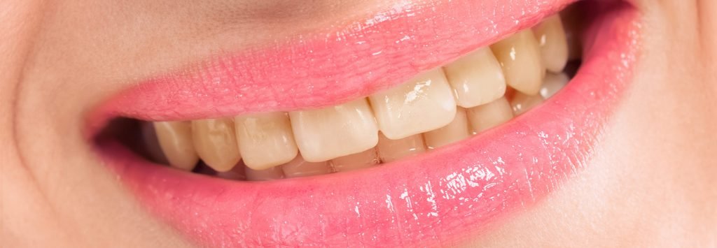 Dental smile before treatment