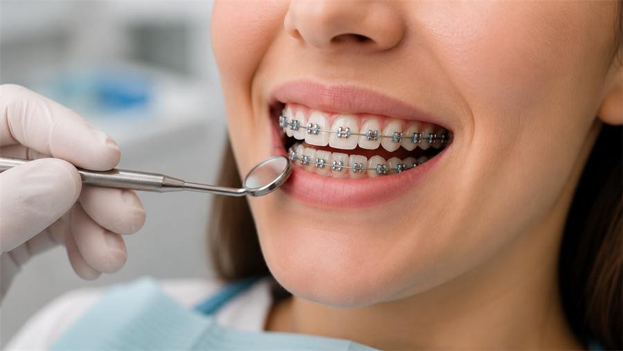 Fixed Orthodontic Therapy